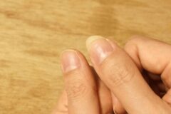 만약 손톱에 “이런 증상” 보인다면 혈액 속 단백질 전부 빠져나가는 겁니다.
