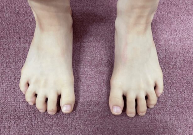 하루 딱 5분만 “발가락을 이렇게” 해보세요 의사들도 놀란 효과 나옵니다.
