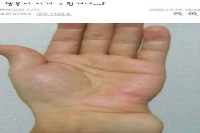 의사가 바라본 손목 브레이커.jpg