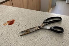 “녹슨 가위에 케첩을 발라보세요” 새로 산 가위처럼 반짝반짝해집니다