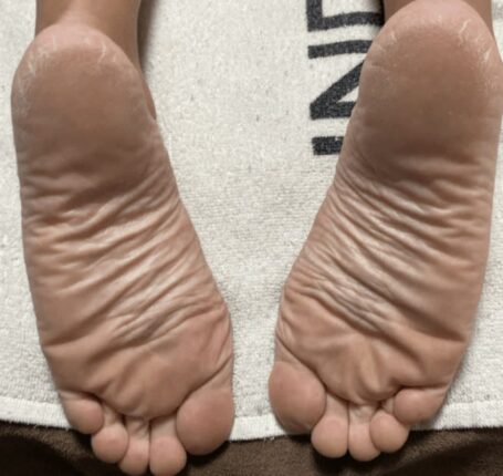 발 씻을 때 “꼭 이렇게” 씻으세요 무좀 곰팡이 단번에 없애는 방법 입니다.