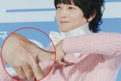 목 부상 감추려고 대형 리본? 상처투성이 손등 드러낸 강동원, 대체 무슨 일이…