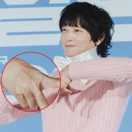 목 부상 감추려고 대형 리본? 상처투성이 손등 드러낸 강동원, 대체 무슨 일이…