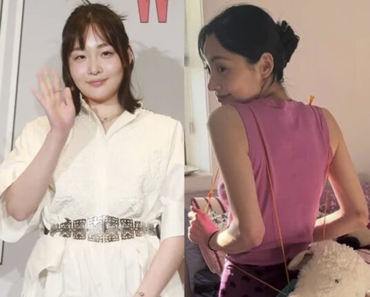 “주근깨·살 빼기 싫다” 소신파 배우 김민하의 ‘뼈말라’ 근황!