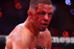 “UFC 악동 맞나?” 네이트 디아즈, 얼굴 피범벅 된 충격 복귀전