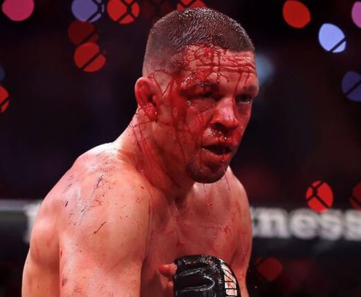 “UFC 악동 맞나?” 네이트 디아즈, 얼굴 피범벅 된 충격 복귀전