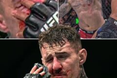 “눈만 3번 찔렸다” UFC 챔피언 오열…수술만 2번, 결국 복귀도 무산