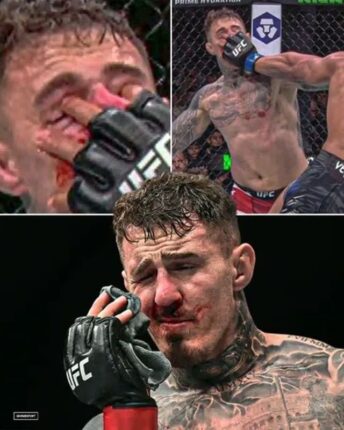 “눈만 3번 찔렸다” UFC 챔피언 오열…수술만 2번, 결국 복귀도 무산