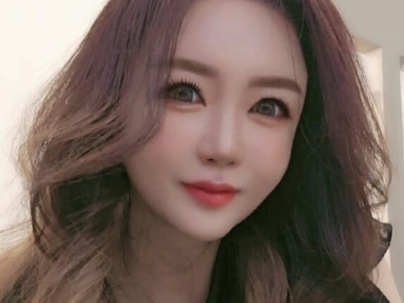 51세 이의정… 뇌종양 완치후 근황