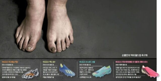 183cm 손흥민 ‘255mm 축구화’ 신는 이유