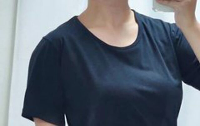 애들아 예뻐지고 싶으면 진짜 승모근부터 없애 (+경험담)